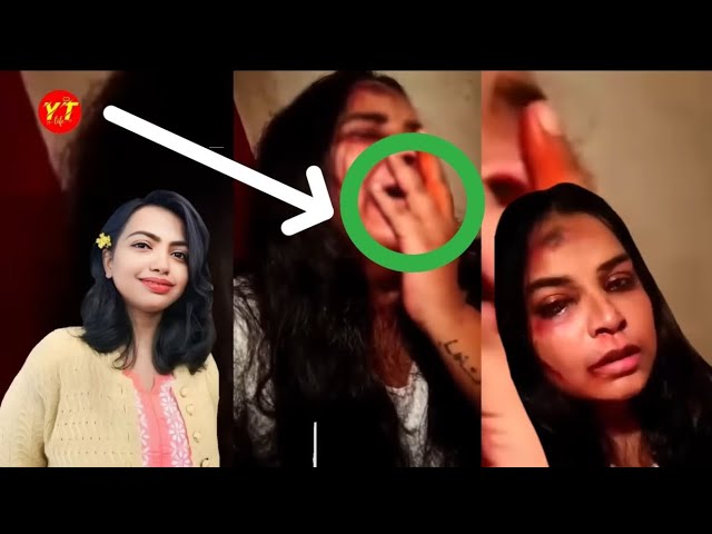 Moumita Original YouTube Viral Video Link , Dr Moumita Debnath Viral Video Link Download